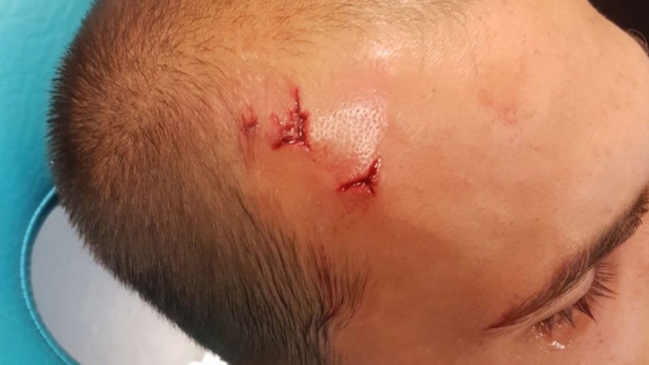 Hinchas invadieron práctica y agredieron a jugadores y DT de Sporting de Lisboa Hinchas invadieron práctica y agredieron a jugadores y DT de Sporting de Lisboa