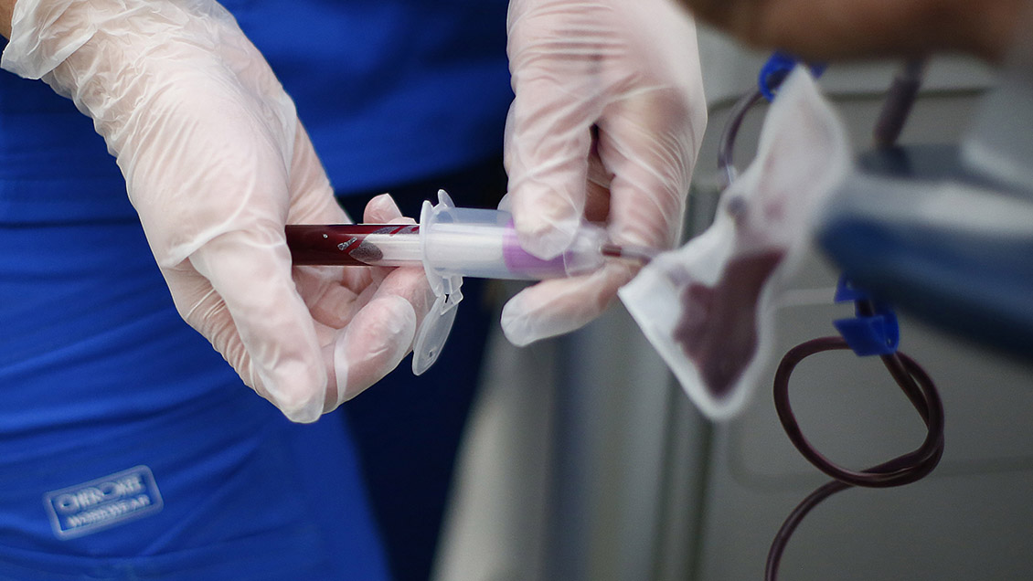 Nuevo análisis de sangre detecta Alzheimer antes de los primeros síntomas