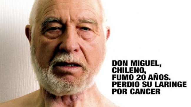 Murió Don Miguel, rostro contra el tabaco que aparecía en las cajetillas de cigarros