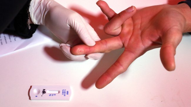 Los casos de VIH aumentaron un 7% en un año, con más de 5.000 nuevos diagnósticos