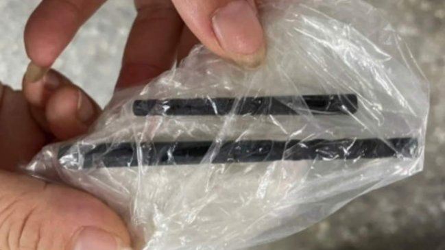 Sufría de constantes dolores de cabeza y descubrió que tenía palillos chinos enterrados en el cerebro