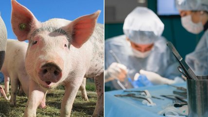   Hombre recibió exitoso trasplante de un riñón de cerdo modificado genéticamente 