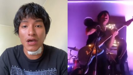   Descarga eléctrica durante show en vivo deja a músico con quemaduras en Lima 