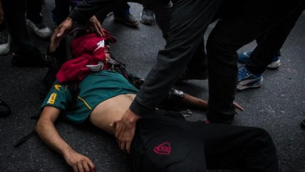  Justicia argentina imputa a gendarme por dejar gravemente herido a fotoperiodista  