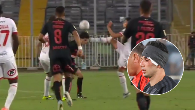 [VIDEO] La dura patada en la cara a Pastrán en la “Noche Alba” entre Colo Colo y Unión Española