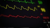 Infarto silencioso: las señales de alerta que no hay que ignorar