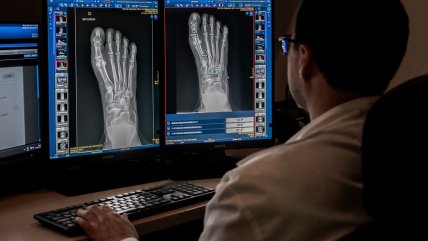   IA en salud: mejores diagnósticos y eficiencia, pero también atención centrada en la persona 